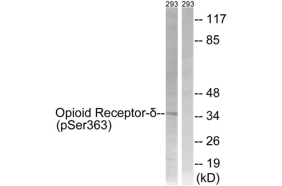 Western Blot - Anti-Opioid Receptor-delta (phospho Ser363) Antibody (A0420) - Antibodies.com