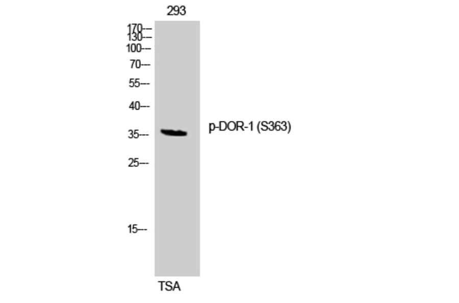 Western Blot - Anti-Opioid Receptor-delta (phospho Ser363) Antibody (A0420) - Antibodies.com