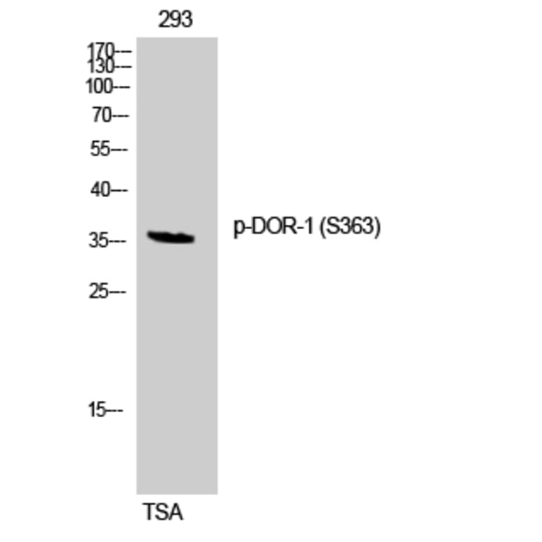 Western Blot - Anti-Opioid Receptor-delta (phospho Ser363) Antibody (A0420) - Antibodies.com