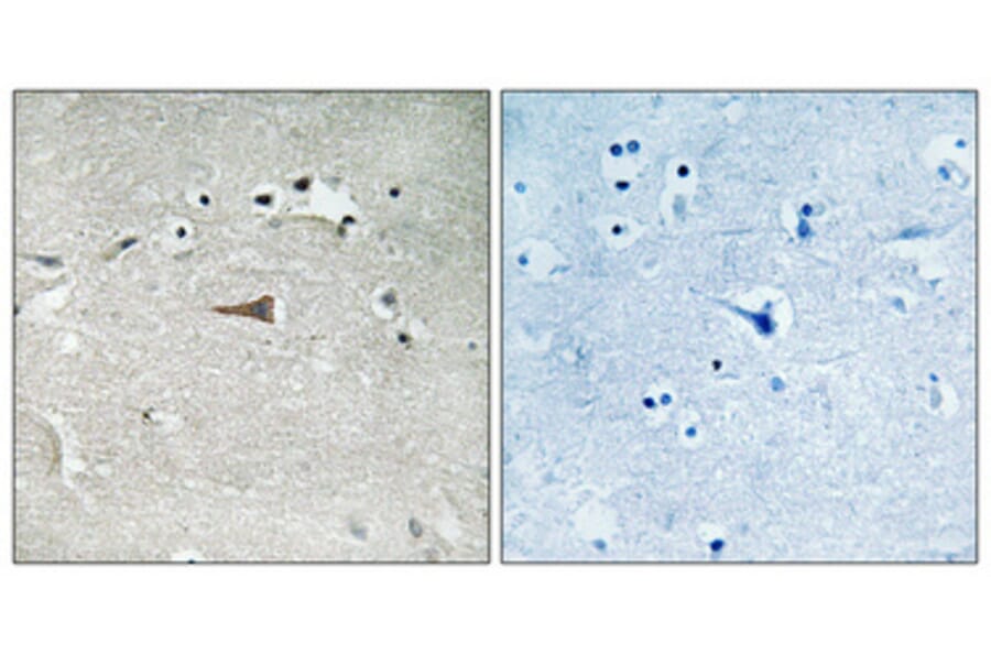 Immunohistochemistry - Anti-Opioid Receptor-delta (phospho Ser363) Antibody (A0420) - Antibodies.com