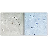 Immunohistochemistry - Anti-Opioid Receptor-delta (phospho Ser363) Antibody (A0420) - Antibodies.com