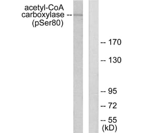 Western Blot - Anti-acetyl CoA Carboxylase (phospho Ser80) Antibody (A0051) - Antibodies.com