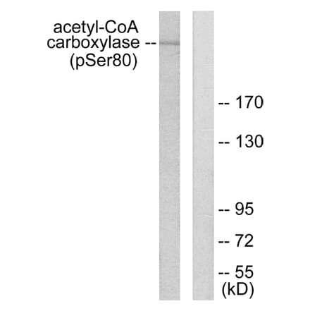 Western Blot - Anti-acetyl CoA Carboxylase (phospho Ser80) Antibody (A0051) - Antibodies.com