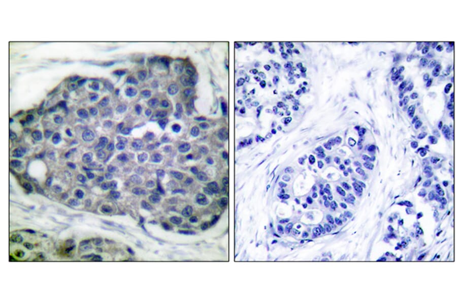 Immunohistochemistry - Anti-acetyl CoA Carboxylase (phospho Ser80) Antibody (A0051) - Antibodies.com