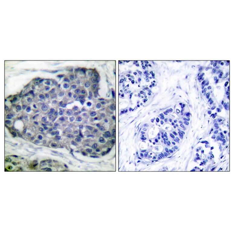 Immunohistochemistry - Anti-acetyl CoA Carboxylase (phospho Ser80) Antibody (A0051) - Antibodies.com