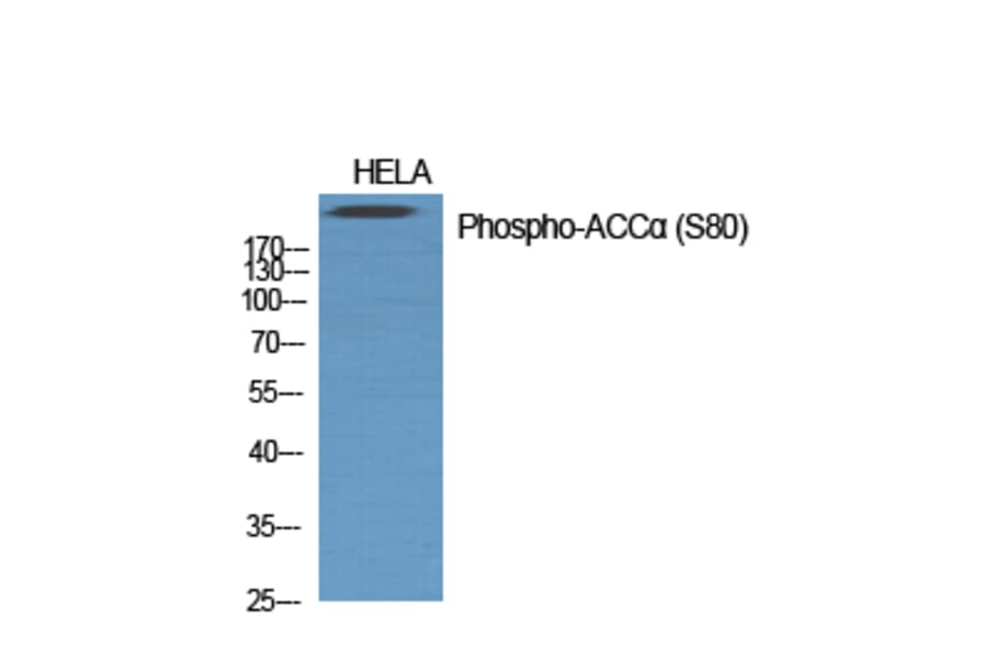 Western Blot - Anti-acetyl CoA Carboxylase (phospho Ser80) Antibody (A0051) - Antibodies.com