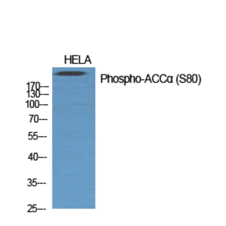 Western Blot - Anti-acetyl CoA Carboxylase (phospho Ser80) Antibody (A0051) - Antibodies.com