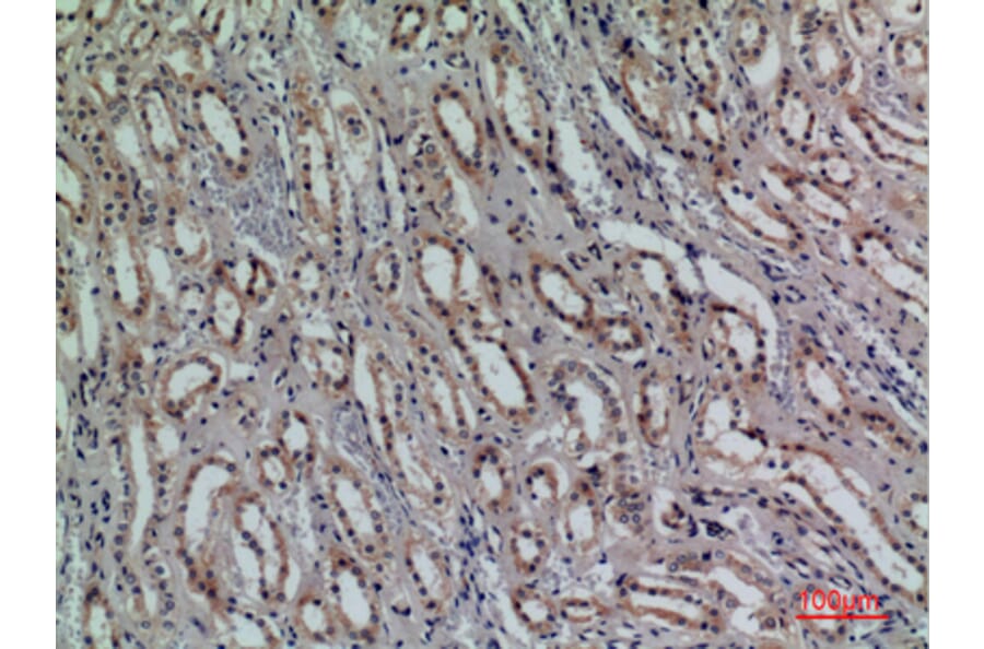 Immunohistochemistry - Anti-KLRC1 + KLRC2 + KLRC3 Antibody (C30576) - Antibodies.com