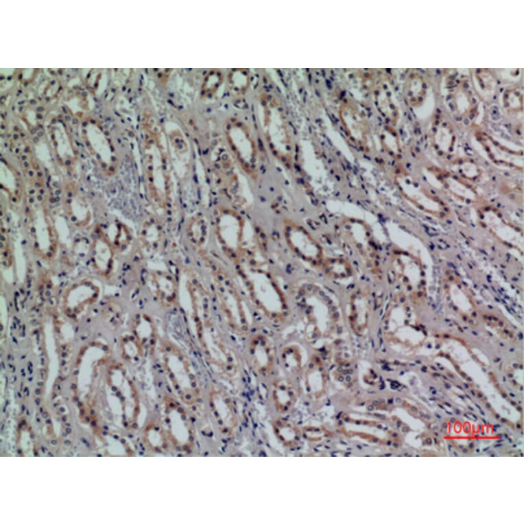 Immunohistochemistry - Anti-KLRC1 + KLRC2 + KLRC3 Antibody (C30576) - Antibodies.com