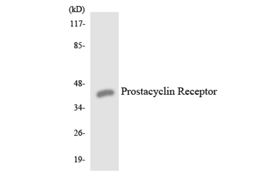 Western Blot - Anti-Prostacyclin Receptor Antibody (R12-3369) - Antibodies.com