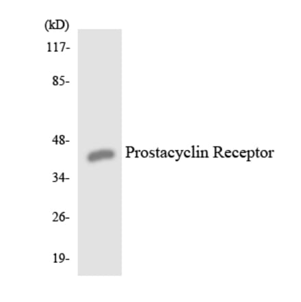 Western Blot - Anti-Prostacyclin Receptor Antibody (R12-3369) - Antibodies.com