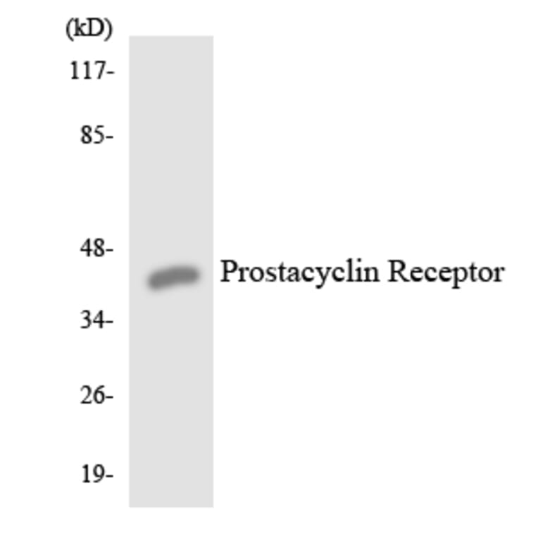 Western Blot - Anti-Prostacyclin Receptor Antibody (R12-3369) - Antibodies.com