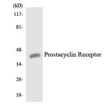 Western Blot - Anti-Prostacyclin Receptor Antibody (R12-3369) - Antibodies.com