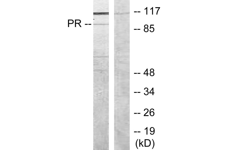 Western Blot - Anti-Progesterone Receptor Antibody (B7200) - Antibodies.com
