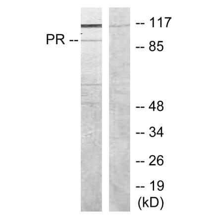 Western Blot - Anti-Progesterone Receptor Antibody (B7200) - Antibodies.com