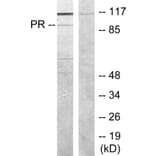 Western Blot - Anti-Progesterone Receptor Antibody (B7200) - Antibodies.com