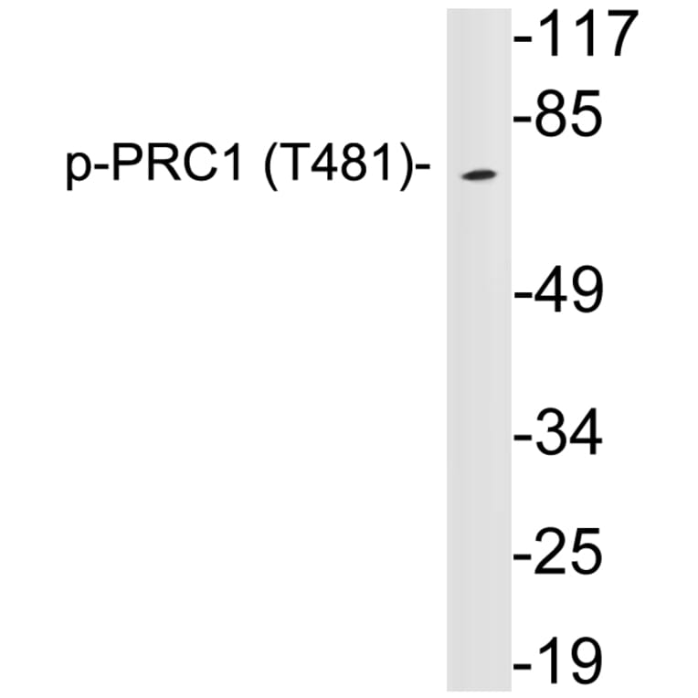 Western Blot - Anti-PRC1 (phospho Thr481) Antibody (P12-1050) - Antibodies.com