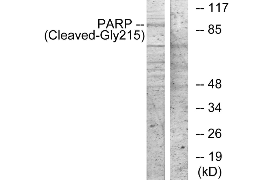Western Blot - Anti-PARP (cleaved Gly215) Antibody (L0366) - Antibodies.com