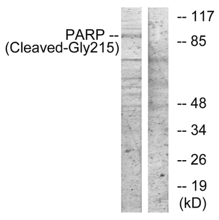 Western Blot - Anti-PARP (cleaved Gly215) Antibody (L0366) - Antibodies.com