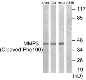 Western Blot - Anti-MMP3 (cleaved Phe100) Antibody (L0336) - Antibodies.com