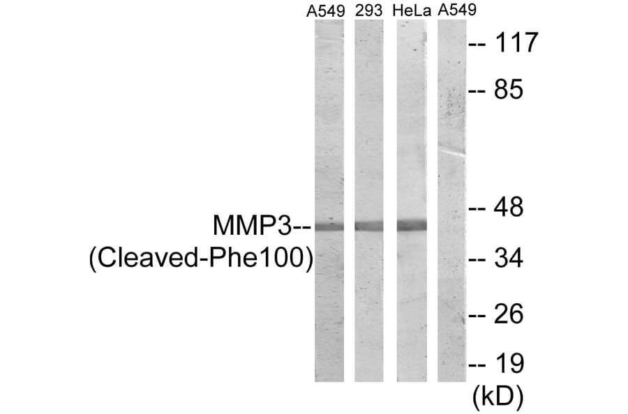 Western Blot - Anti-MMP3 (cleaved Phe100) Antibody (L0336) - Antibodies.com