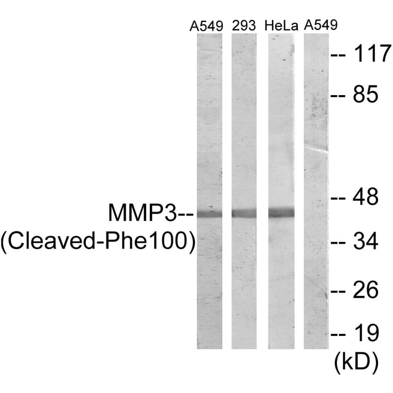 Western Blot - Anti-MMP3 (cleaved Phe100) Antibody (L0336) - Antibodies.com