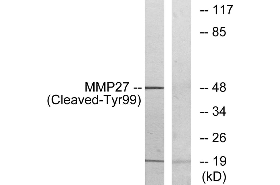 Western Blot - Anti-MMP27 (cleaved Tyr99) Antibody (L0334) - Antibodies.com