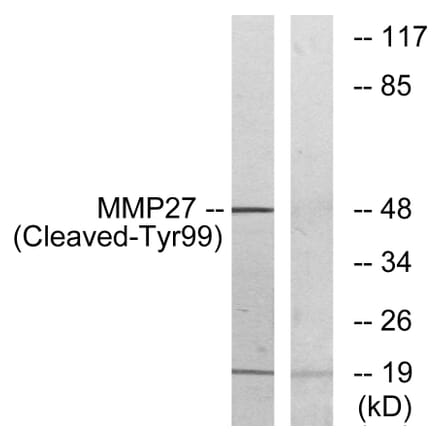 Western Blot - Anti-MMP27 (cleaved Tyr99) Antibody (L0334) - Antibodies.com