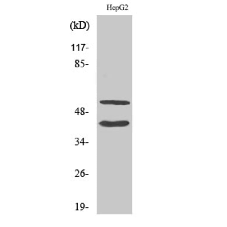 Western Blot - Anti-MMP10 (cleaved Phe99) Antibody (L0318) - Antibodies.com