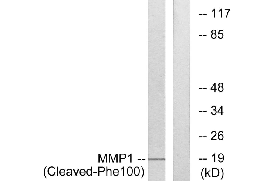 Western Blot - Anti-MMP1 (cleaved Phe100) Antibody (L0316) - Antibodies.com