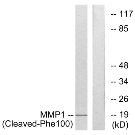 Western Blot - Anti-MMP1 (cleaved Phe100) Antibody (L0316) - Antibodies.com