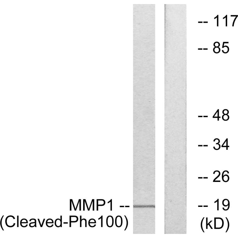 Western Blot - Anti-MMP1 (cleaved Phe100) Antibody (L0316) - Antibodies.com