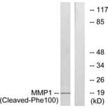Western Blot - Anti-MMP1 (cleaved Phe100) Antibody (L0316) - Antibodies.com