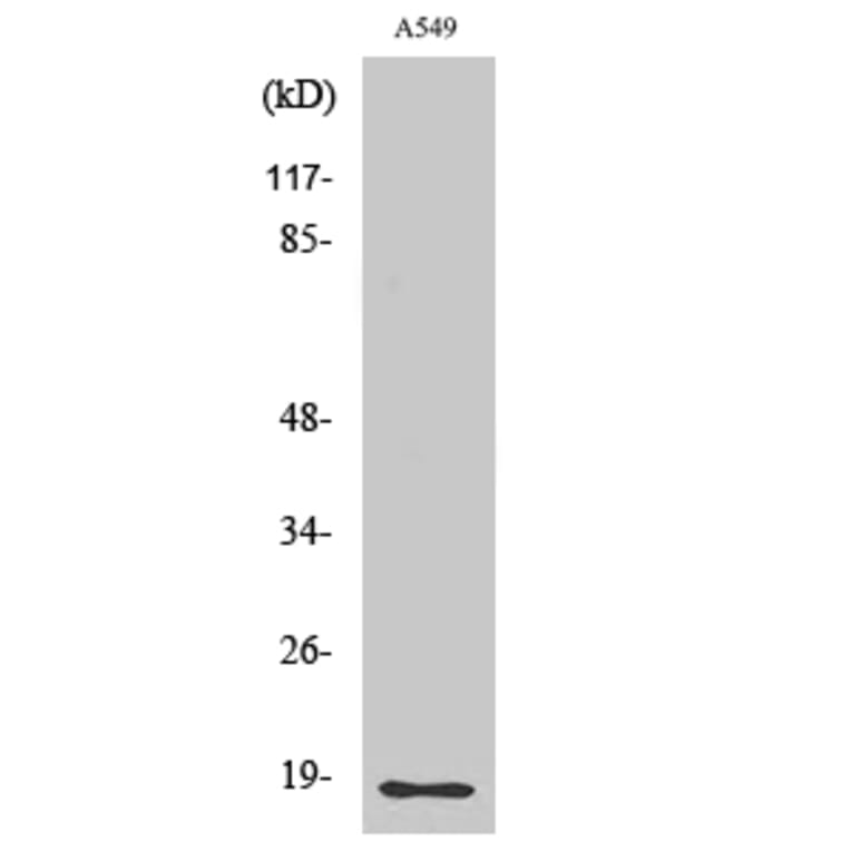 Western Blot - Anti-MMP1 (cleaved Phe100) Antibody (L0316) - Antibodies.com