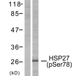 Western Blot - Anti-HSP27 (phospho Ser78) Antibody (A7111) - Antibodies.com