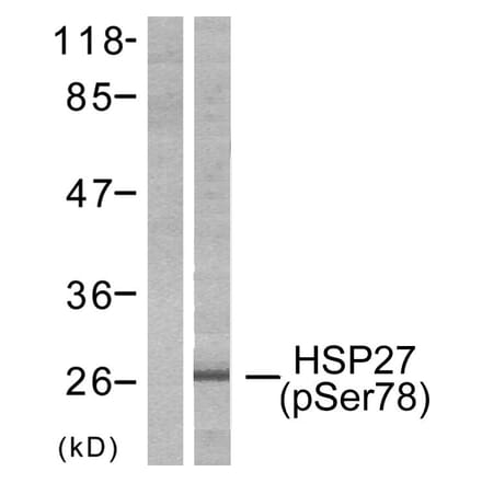 Western Blot - Anti-HSP27 (phospho Ser78) Antibody (A7111) - Antibodies.com