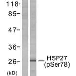 Western Blot - Anti-HSP27 (phospho Ser78) Antibody (A7111) - Antibodies.com