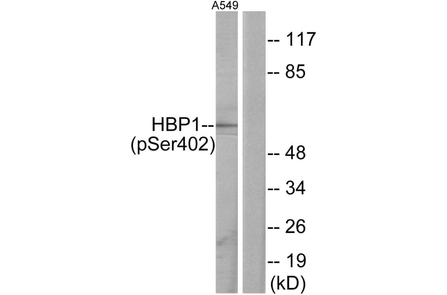 Western Blot - Anti-HBP1 (phospho Ser402) Antibody (A1035) - Antibodies.com