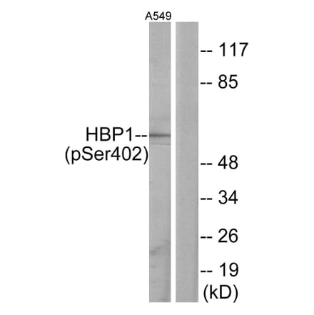 Western Blot - Anti-HBP1 (phospho Ser402) Antibody (A1035) - Antibodies.com