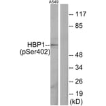 Western Blot - Anti-HBP1 (phospho Ser402) Antibody (A1035) - Antibodies.com