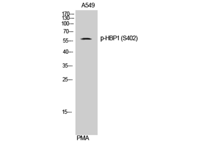 Western Blot - Anti-HBP1 (phospho Ser402) Antibody (A1035) - Antibodies.com