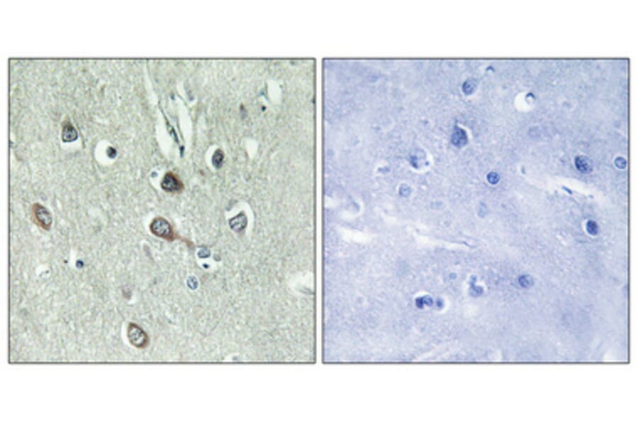 Immunohistochemistry - Anti-HBP1 (phospho Ser402) Antibody (A1035) - Antibodies.com
