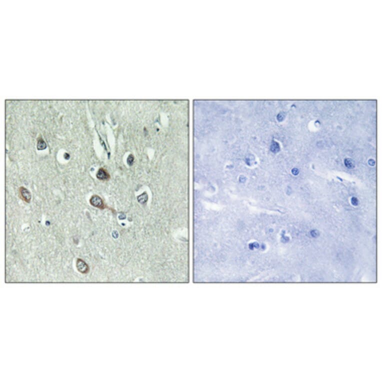 Immunohistochemistry - Anti-HBP1 (phospho Ser402) Antibody (A1035) - Antibodies.com