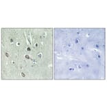 Immunohistochemistry - Anti-HBP1 (phospho Ser402) Antibody (A1035) - Antibodies.com