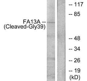 Western Blot - Anti-FA13A (cleaved Gly39) Antibody (L0206) - Antibodies.com