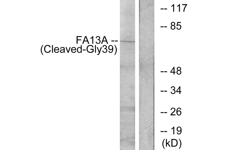 Western Blot - Anti-FA13A (cleaved Gly39) Antibody (L0206) - Antibodies.com