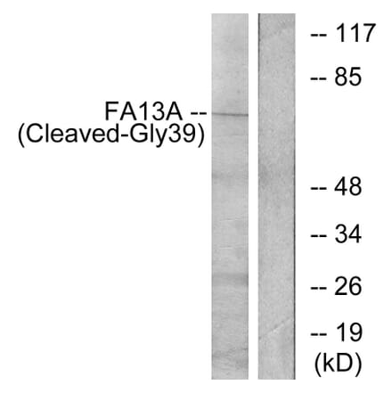 Western Blot - Anti-FA13A (cleaved Gly39) Antibody (L0206) - Antibodies.com