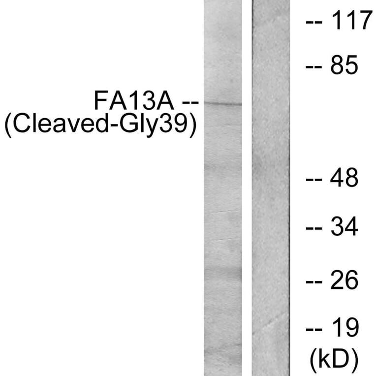 Western Blot - Anti-FA13A (cleaved Gly39) Antibody (L0206) - Antibodies.com