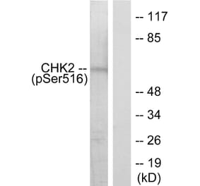 Western Blot - Anti-Chk2 (phospho Ser516) Antibody (A7043) - Antibodies.com