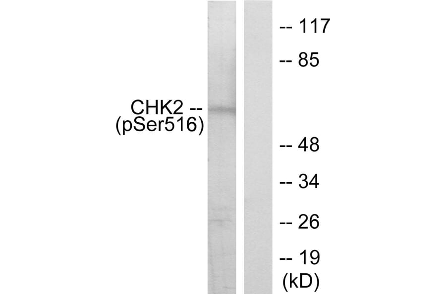 Western Blot - Anti-Chk2 (phospho Ser516) Antibody (A7043) - Antibodies.com